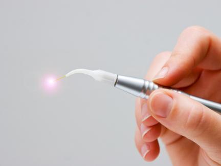 Kurz erklärt: Behandlung mit dem Dentallaser