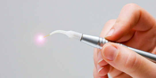 Kurz erklärt: Behandlung mit dem Dentallaser